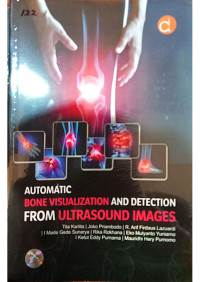 Image of Automatic Bone Visualization And Detection From Ultrasound Images